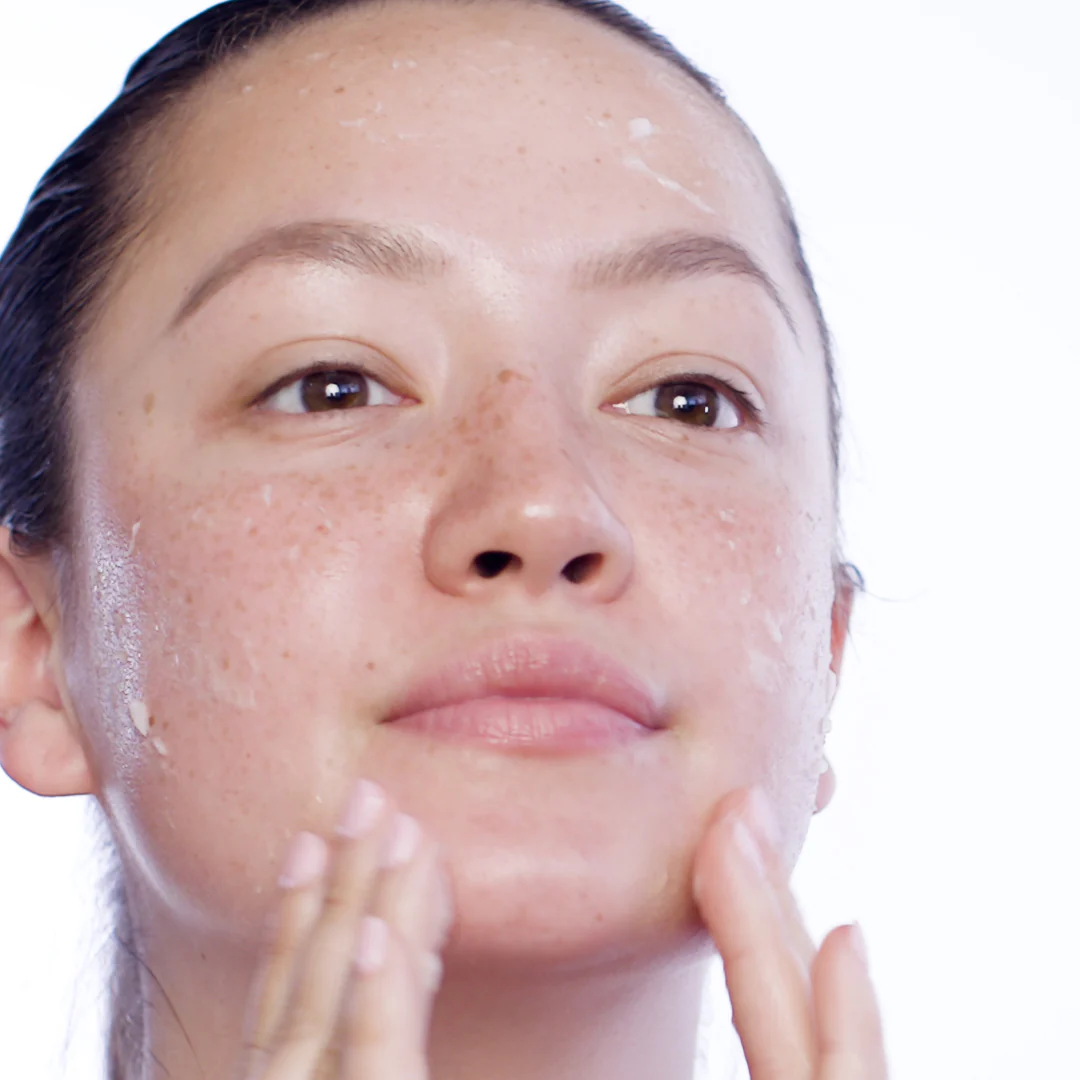 Clarity Acid Peel - Image 3
