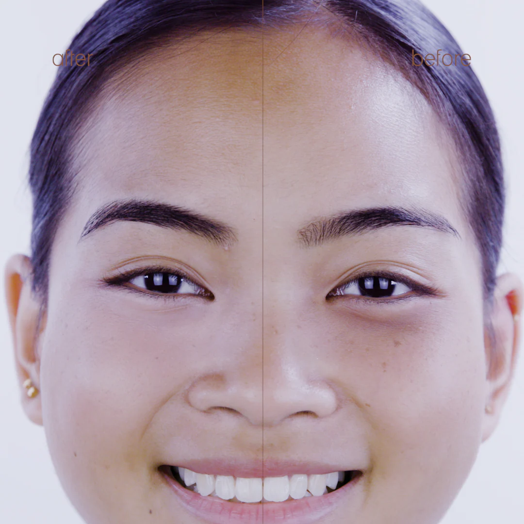 Correction Concentrate - Image 7